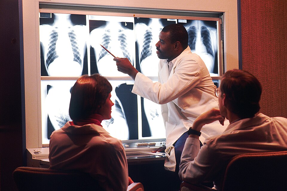 Three physicians examining chest x-rays